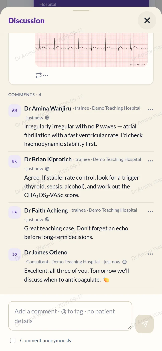 Colleagues discussing the ECG in the comments